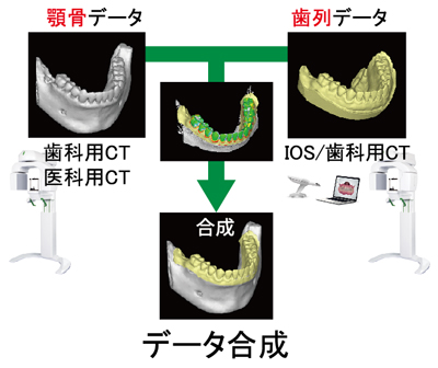 自院でデータ合成