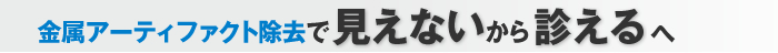 次世代CT再構成ソフト