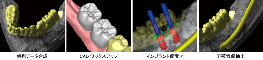 データ発注