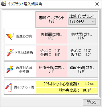 インプラントメモリー