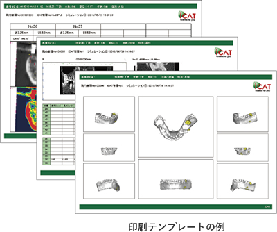 印刷用テンプレート