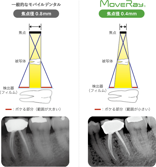 極小焦点径0.4mm