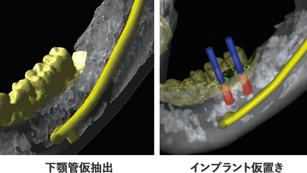 先生方の労力を軽減