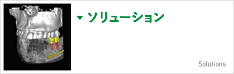 ソリューション