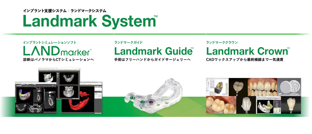 インプラント支援システム Landmark System