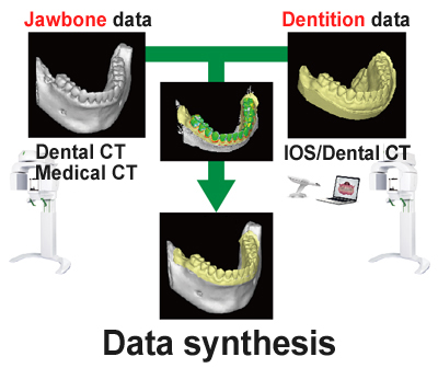 Data synthesis at your own clinic