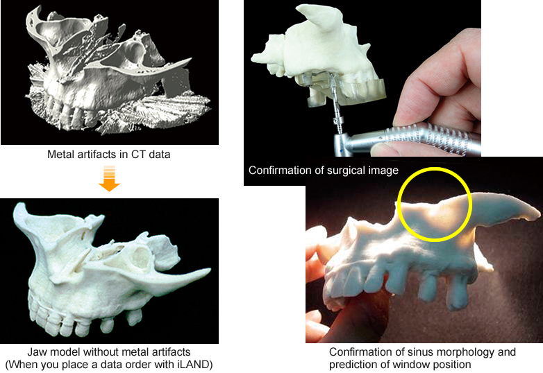 Jaw Model