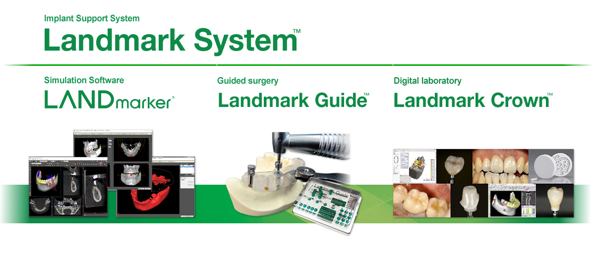 Landmark System