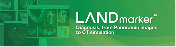 LANDmarker™ Diagnosis, from Panoramic images to CT simulation