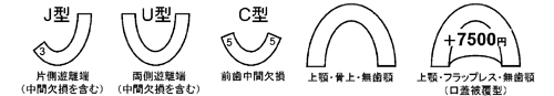 ガイド基本形状